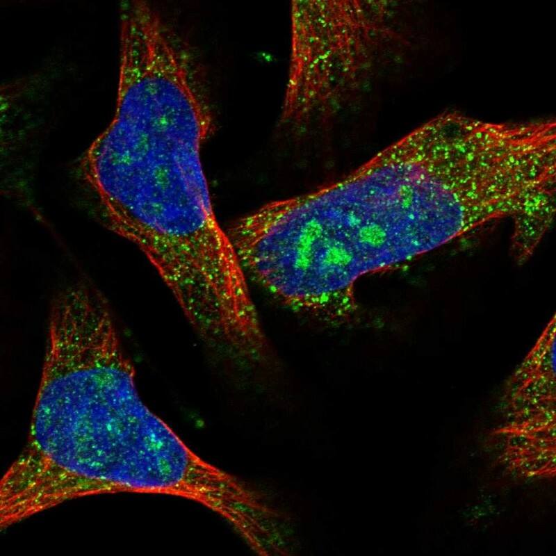 ACOX1 Antibody - BSA Free Immunocytochemistry/ Immunofluorescence: ACOX1 Antibody [NBP1-80950]