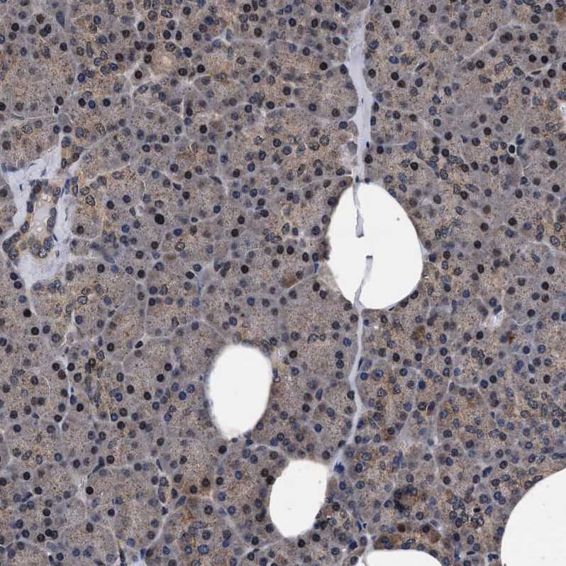 ACOX1 Antibody - BSA Free Immunohistochemistry-Paraffin: ACOX1 Antibody [NBP1-80951]
