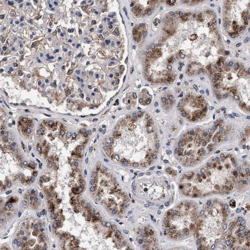 ACOX1 Antibody - BSA Free Immunohistochemistry-Paraffin: ACOX1 Antibody [NBP1-80951]