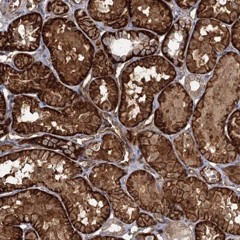 RPP14 Antibody - BSA Free Immunohistochemistry-Paraffin: RPP14 Antibody [NBP1-80965]
