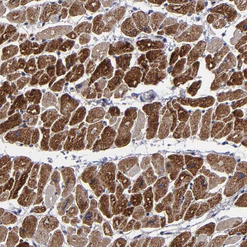 ZNF175 Antibody - BSA Free Immunohistochemistry-Paraffin: ZNF175 Antibody [NBP1-80969]