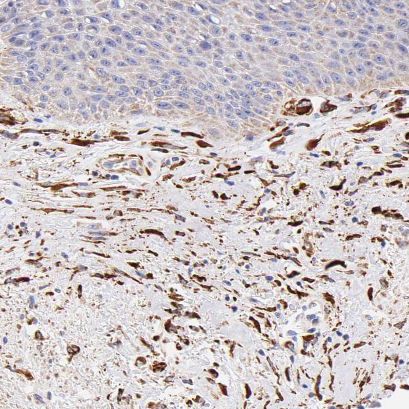 SPARC Antibody - BSA Free Immunohistochemistry-Paraffin: SPARC Antibody [NBP1-80971]