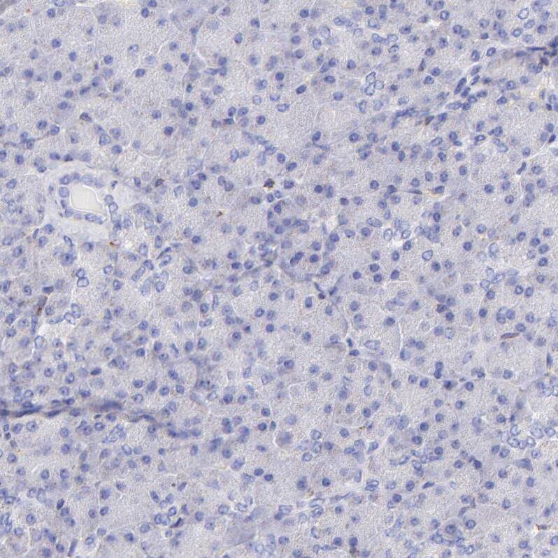 SPARC Antibody - BSA Free Immunohistochemistry-Paraffin: SPARC Antibody [NBP1-80971]