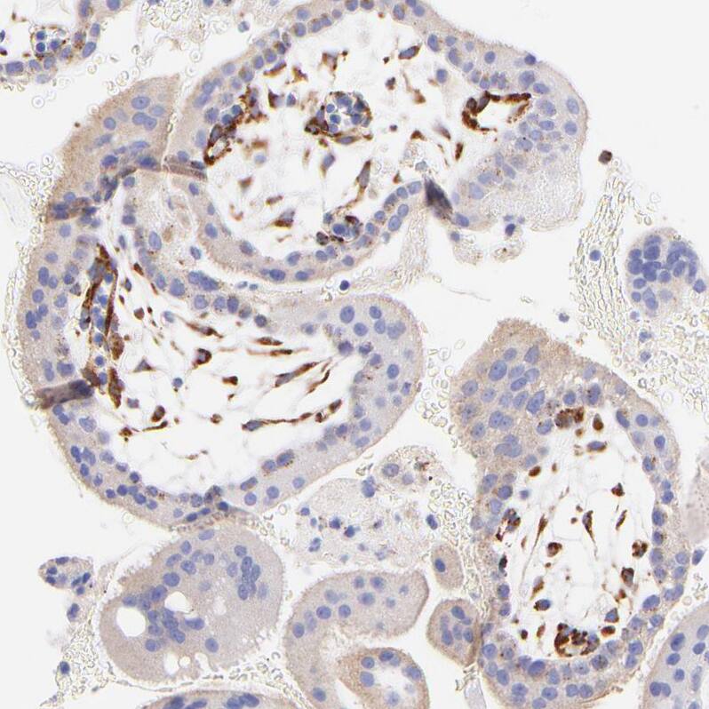 SPARC Antibody - BSA Free Immunohistochemistry-Paraffin: SPARC Antibody [NBP1-80971]