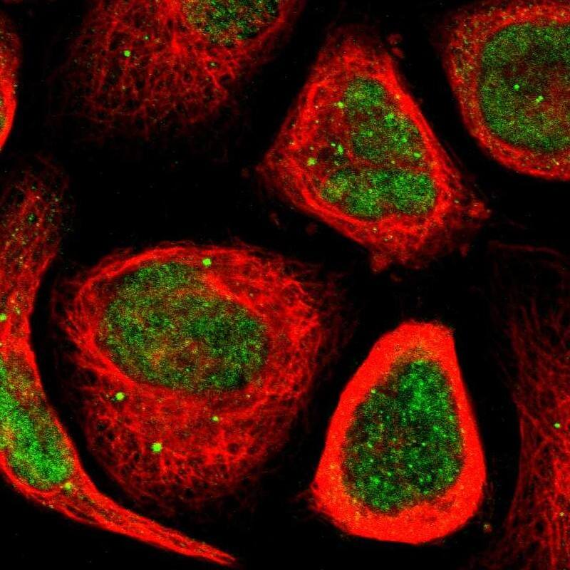 MYEOV Antibody - BSA Free Immunocytochemistry/ Immunofluorescence: MYEOV Antibody [NBP1-80974]