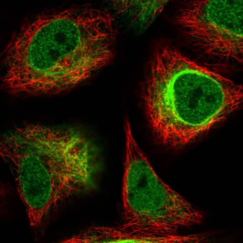 alpha-Internexin Antibody - BSA Free Immunocytochemistry/ Immunofluorescence: alpha-Internexin Antibody [NBP1-81007]