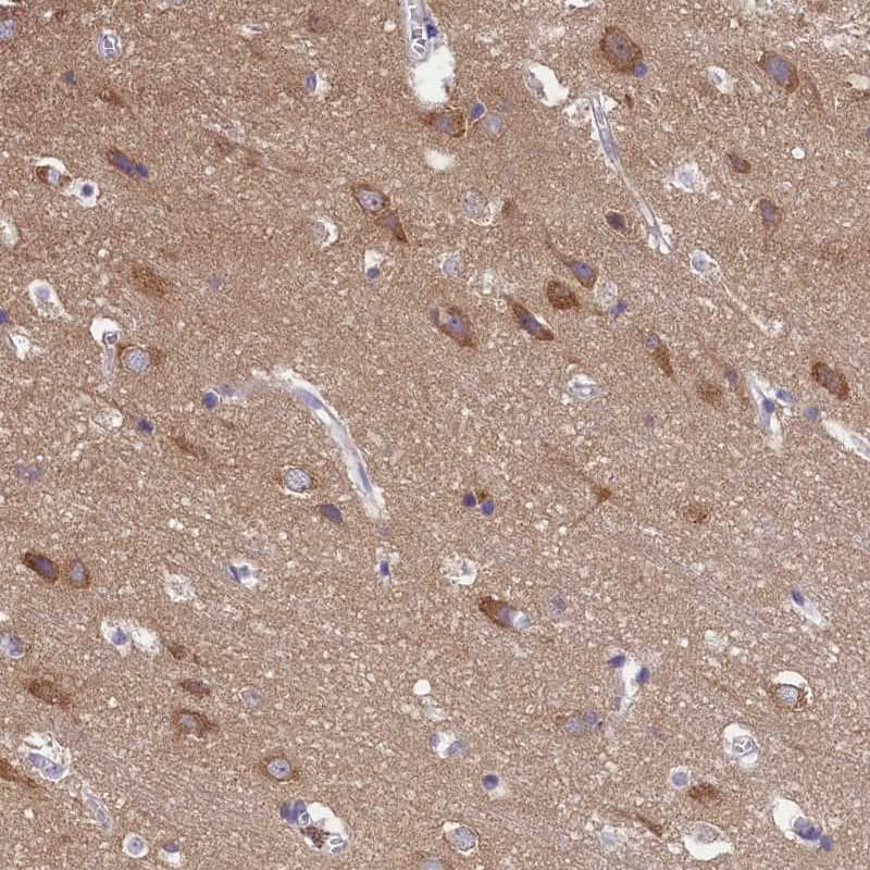 AP3B2 Antibody - BSA Free (NBP1-81012) by Novus, Part of Bio-Techne