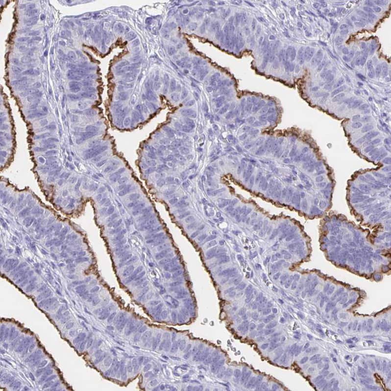 SLC34A2 Antibody - BSA Free Immunohistochemistry-Paraffin: SLC34A2 Antibody [NBP1-81013]