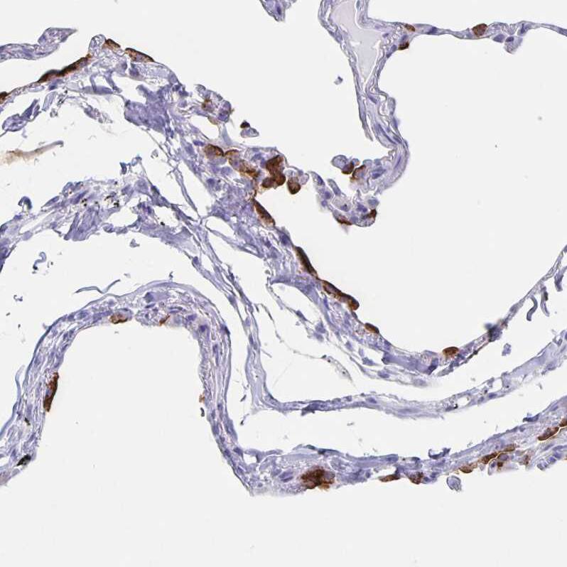 SLC34A2 Antibody - BSA Free Immunohistochemistry-Paraffin: SLC34A2 Antibody [NBP1-81013]