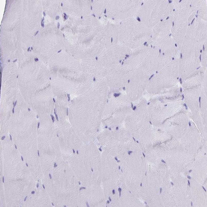 SLC34A2 Antibody - BSA Free Immunohistochemistry-Paraffin: SLC34A2 Antibody [NBP1-81013]
