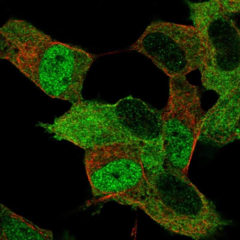 Myt1 Antibody - BSA Free Immunocytochemistry/ Immunofluorescence: Myt1 Antibody [NBP1-81021]