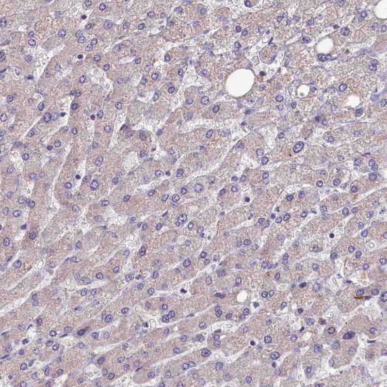 FUNDC1 Antibody - BSA Free Immunohistochemistry-Paraffin: FUNDC1 Antibody [NBP1-81063]