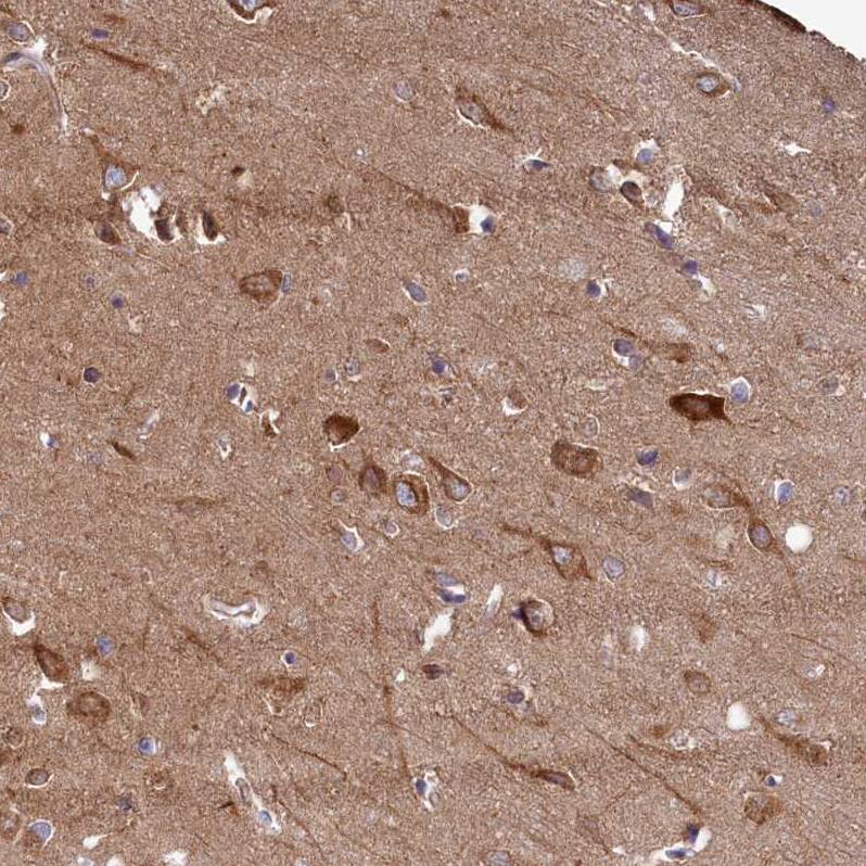 FUNDC1 Antibody - BSA Free Immunohistochemistry-Paraffin: FUNDC1 Antibody [NBP1-81063]