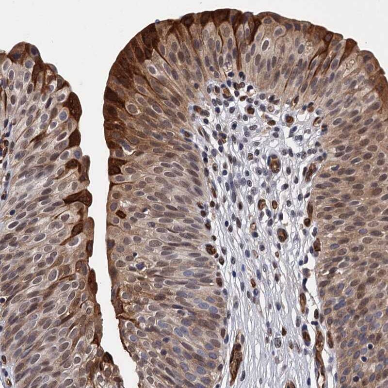 GDPD3 Antibody - BSA Free Immunohistochemistry-Paraffin: GDPD3 Antibody [NBP1-81082]
