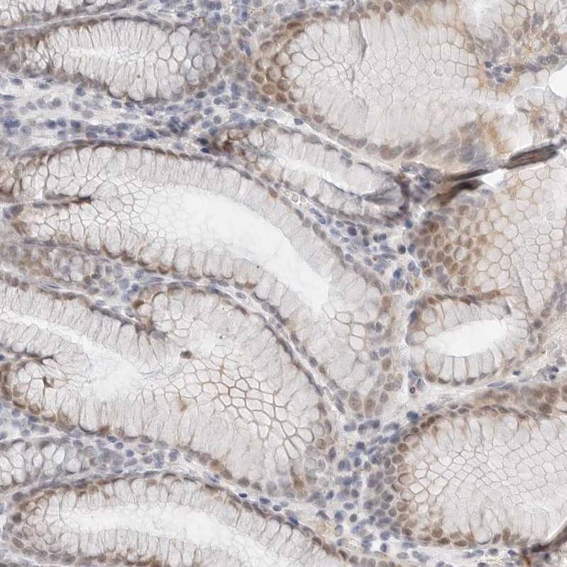 TSEN2 Antibody - BSA Free Immunohistochemistry-Paraffin: TSEN2 Antibody [NBP1-81140]