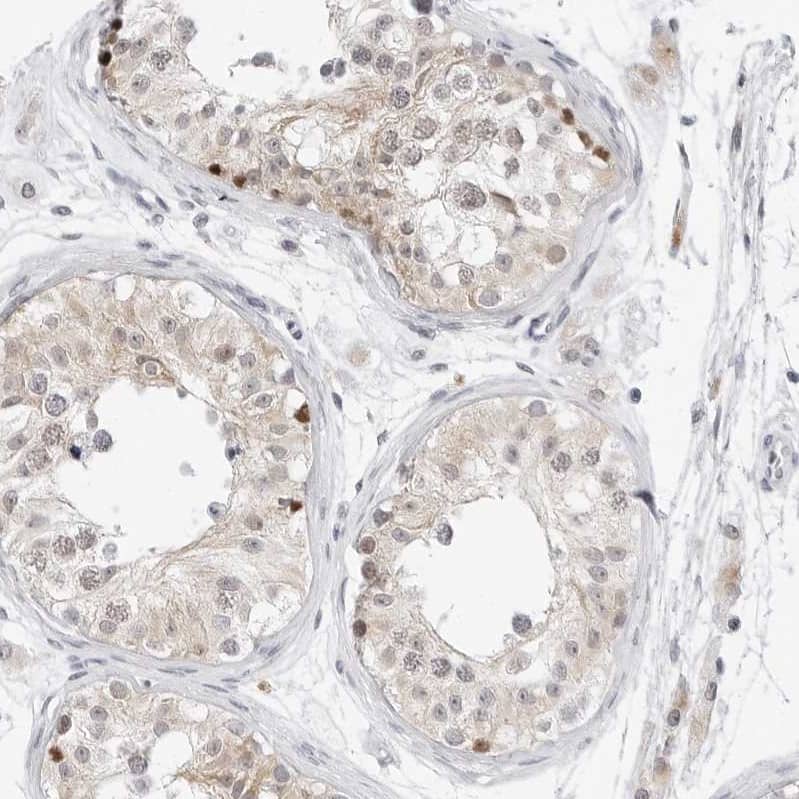 TSEN2 Antibody - BSA Free Immunohistochemistry-Paraffin: TSEN2 Antibody [NBP1-81140]