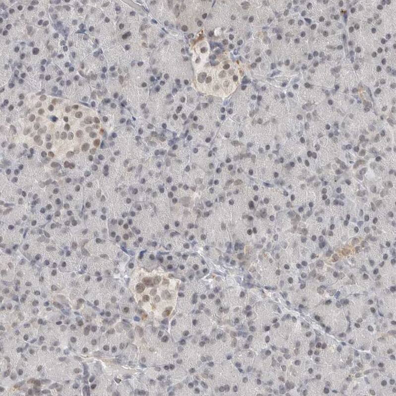 TSEN2 Antibody - BSA Free Immunohistochemistry-Paraffin: TSEN2 Antibody [NBP1-81140]