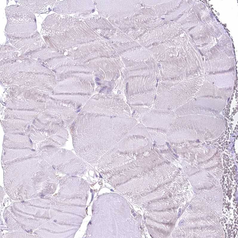 LRRC34 Antibody - BSA Free Immunohistochemistry-Paraffin: LRRC34 Antibody [NBP1-81146]