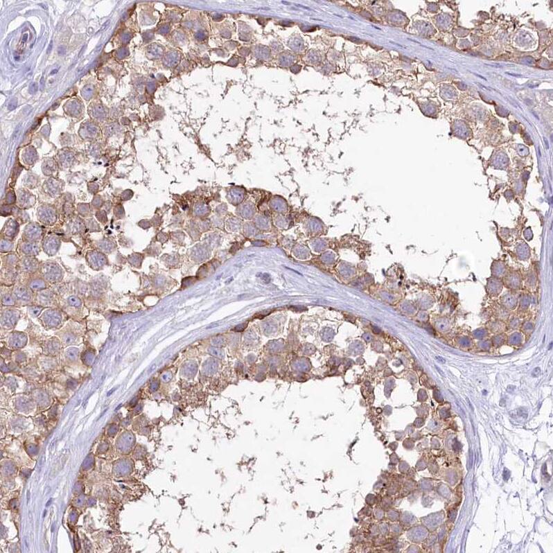 LRRC34 Antibody - BSA Free Immunohistochemistry-Paraffin: LRRC34 Antibody [NBP1-81146]