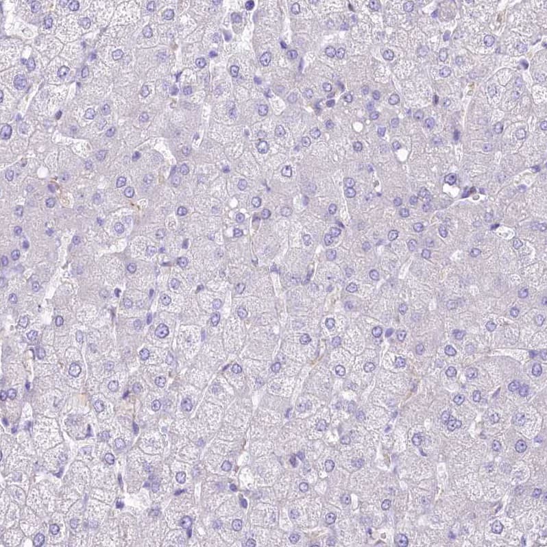 LRRC34 Antibody - BSA Free Immunohistochemistry-Paraffin: LRRC34 Antibody [NBP1-81146]