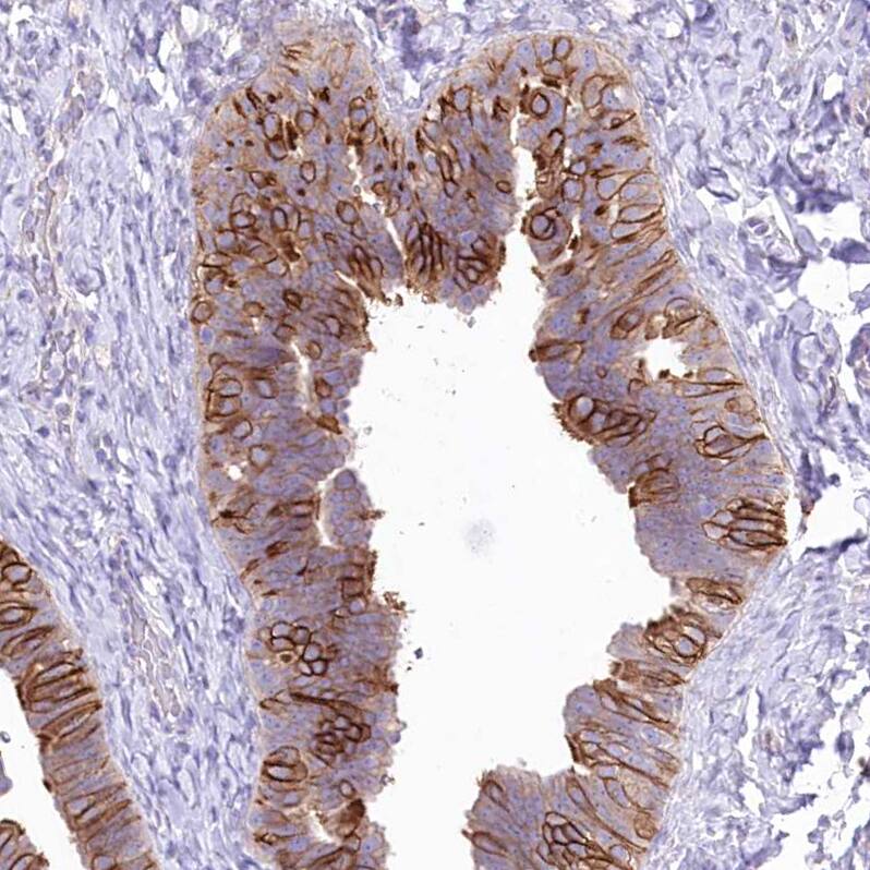 LRRC34 Antibody - BSA Free Immunohistochemistry-Paraffin: LRRC34 Antibody [NBP1-81146]