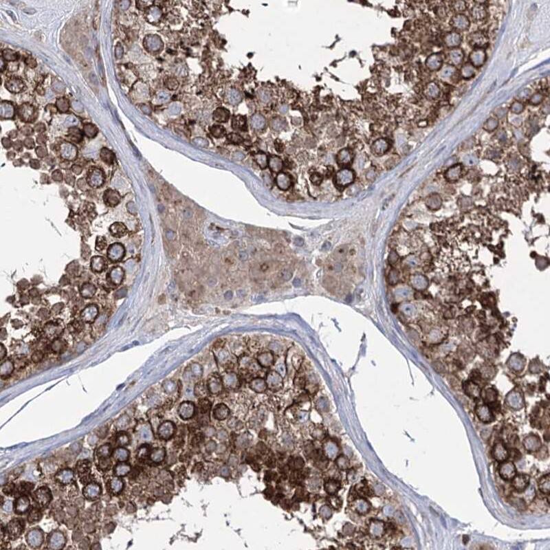 ZNF622 Antibody - BSA Free Immunohistochemistry-Paraffin: ZNF622 Antibody [NBP1-81183]