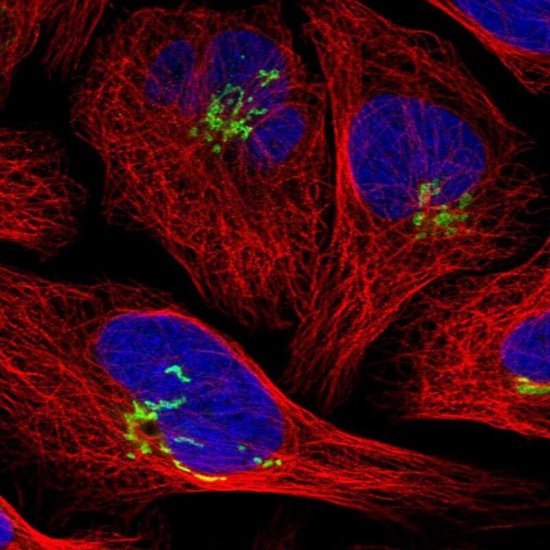 SLC38A10 Antibody - BSA Free Immunocytochemistry/ Immunofluorescence: SLC38A10 Antibody [NBP1-81193]