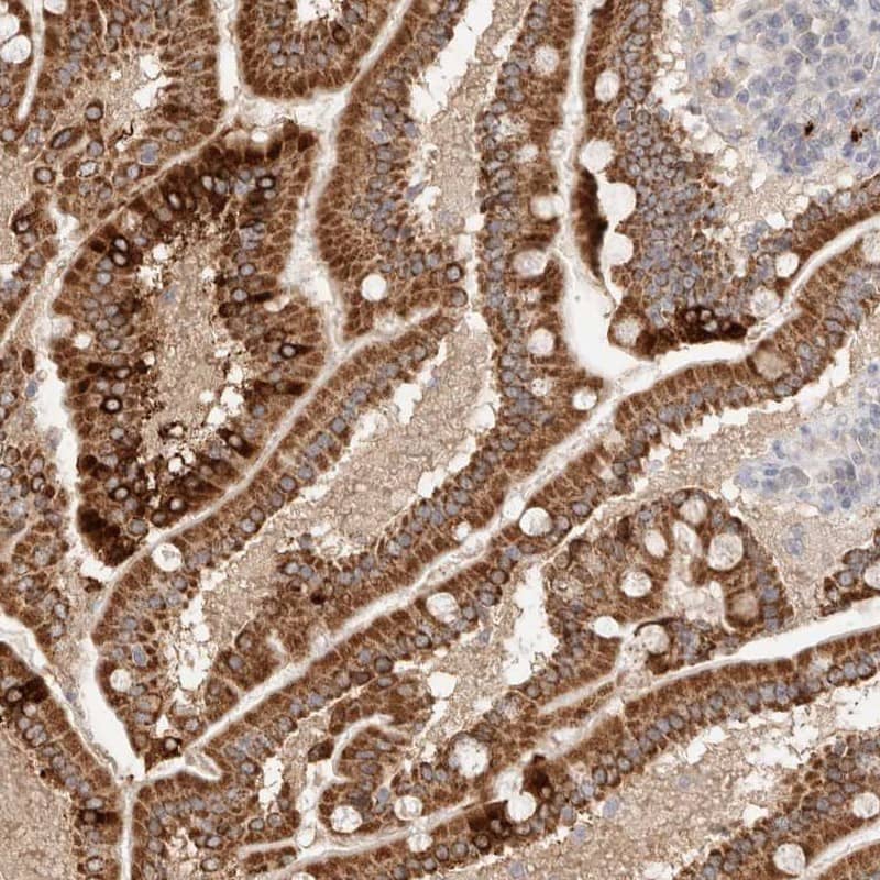 TRIM41 Antibody - BSA Free Immunohistochemistry-Paraffin: TRIM41 Antibody [NBP1-81227]