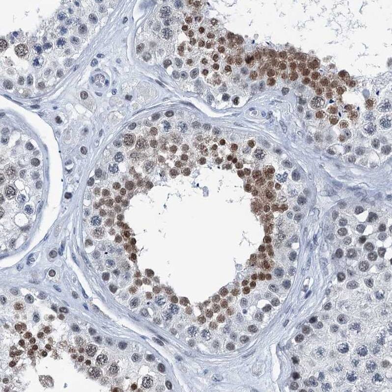 TRPT1 Antibody - BSA Free Immunohistochemistry-Paraffin: TRPT1 Antibody [NBP1-81230]