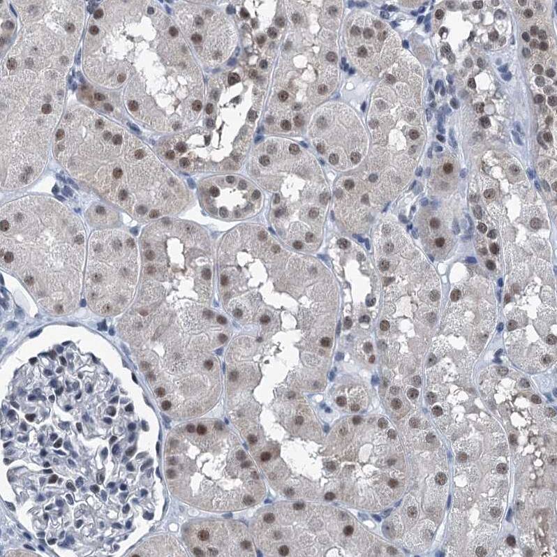 TRPT1 Antibody - BSA Free Immunohistochemistry-Paraffin: TRPT1 Antibody [NBP1-81230]