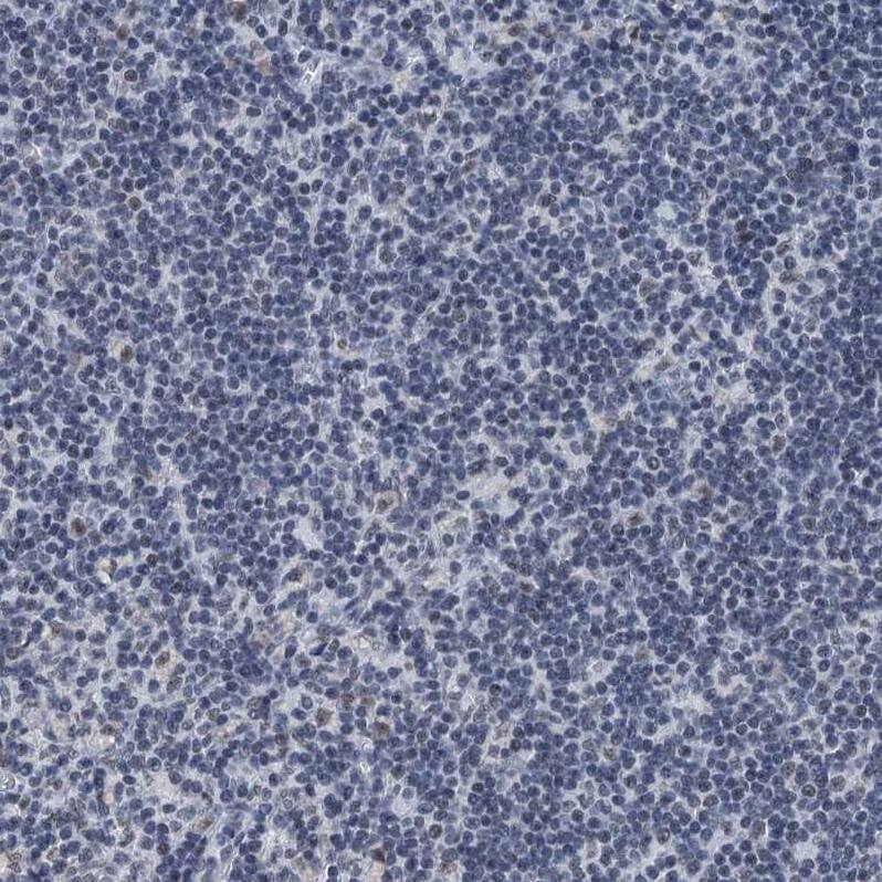TRPT1 Antibody - BSA Free Immunohistochemistry-Paraffin: TRPT1 Antibody [NBP1-81230]