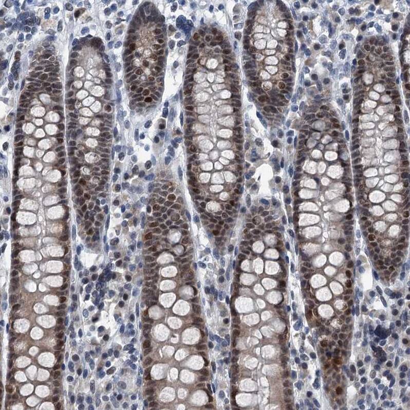 TRPT1 Antibody - BSA Free Immunohistochemistry-Paraffin: TRPT1 Antibody [NBP1-81230]