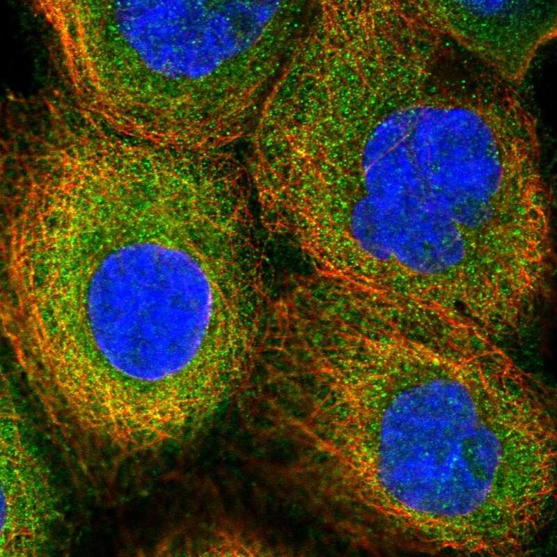 PIGN Antibody - BSA Free Immunocytochemistry/ Immunofluorescence: PIGN Antibody [NBP1-81249]