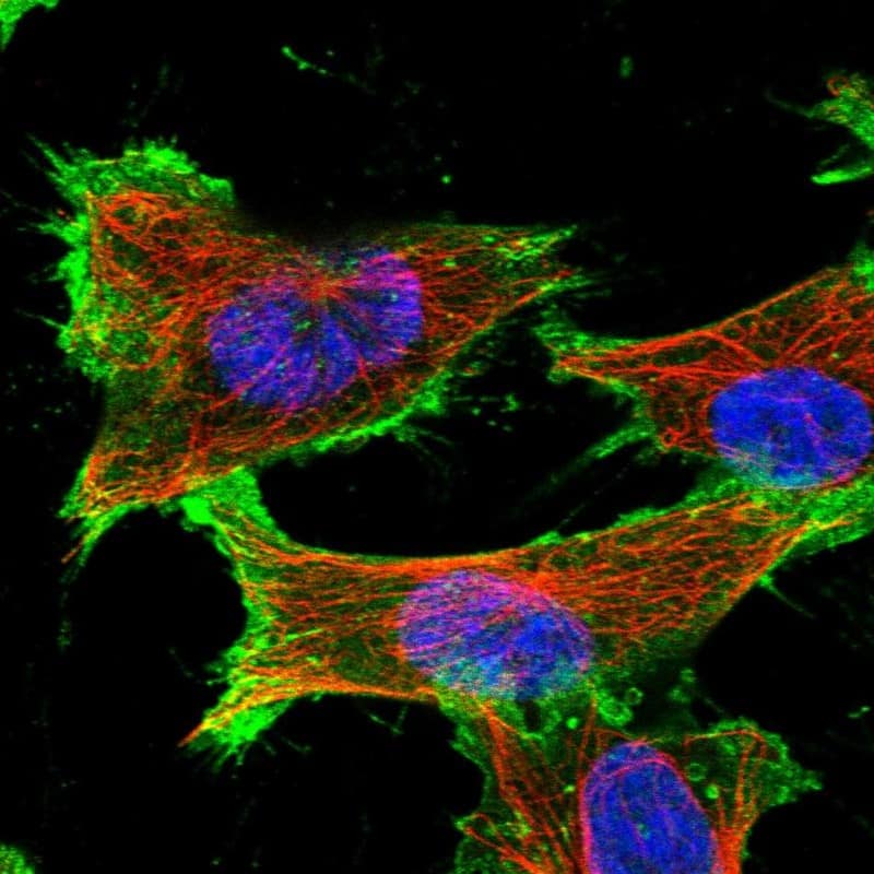 SLC16A3 Antibody - BSA Free Immunocytochemistry/ Immunofluorescence: SLC16A3 Antibody [NBP1-81251]