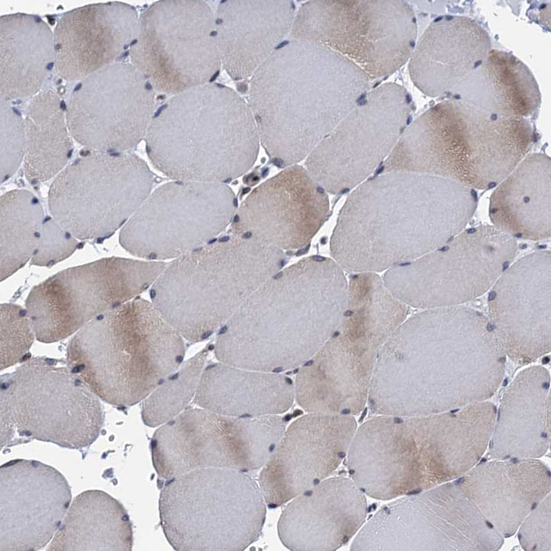 TMEM205 Antibody - BSA Free Immunohistochemistry-Paraffin: TMEM205 Antibody [NBP1-81255]
