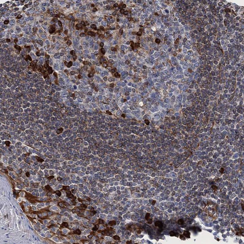 TMEM205 Antibody - BSA Free Immunohistochemistry-Paraffin: TMEM205 Antibody [NBP1-81255]
