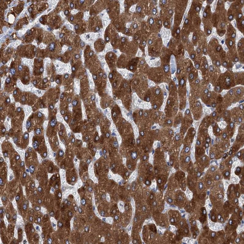TMEM205 Antibody - BSA Free Immunohistochemistry-Paraffin: TMEM205 Antibody [NBP1-81255]