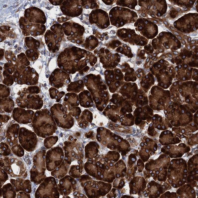 TMEM205 Antibody - BSA Free Immunohistochemistry-Paraffin: TMEM205 Antibody [NBP1-81255]