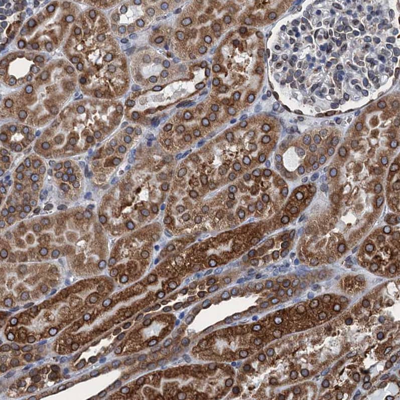 TMEM205 Antibody - BSA Free Immunohistochemistry-Paraffin: TMEM205 Antibody [NBP1-81255]