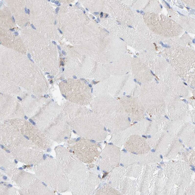 MAP1B Antibody - BSA Free Immunohistochemistry-Paraffin: MAP1B Antibody [NBP1-81261]