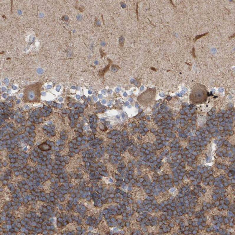 MAP1B Antibody - BSA Free Immunohistochemistry-Paraffin: MAP1B Antibody [NBP1-81261]
