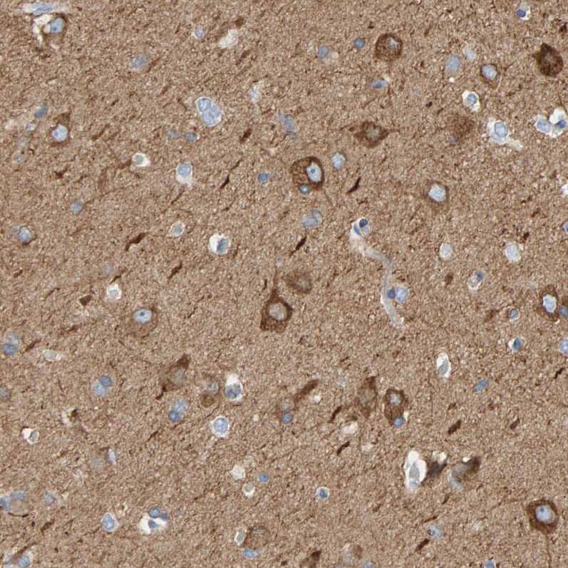 MAP1B Antibody - BSA Free Immunohistochemistry-Paraffin: MAP1B Antibody [NBP1-81261]