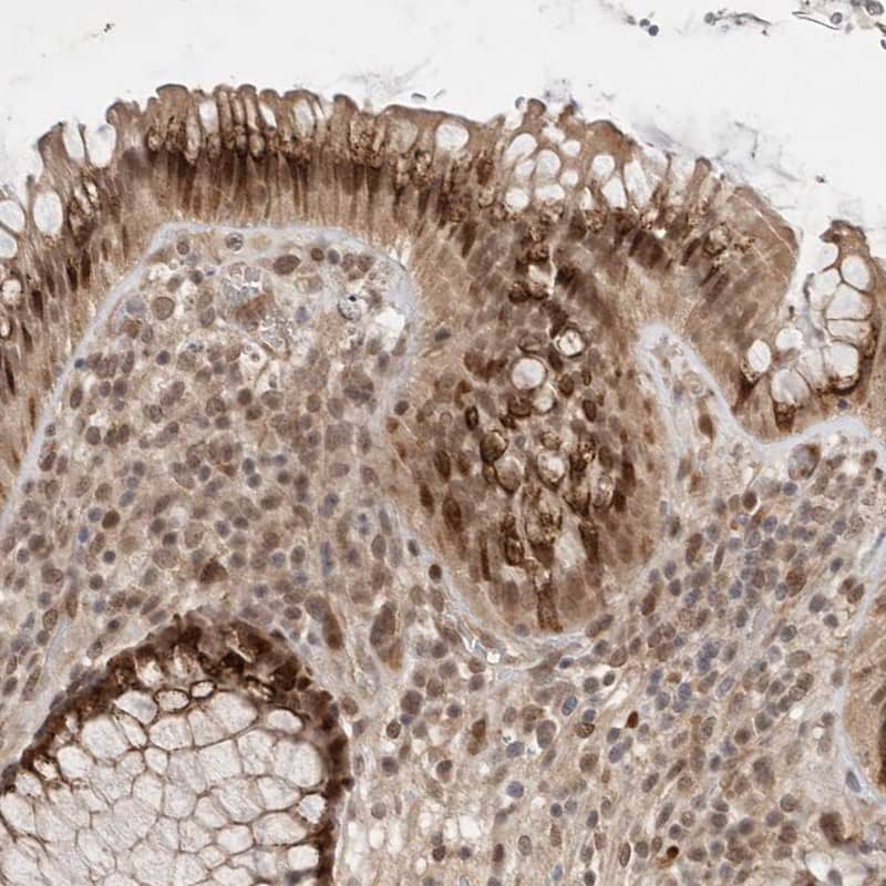 LEMD3 Antibody - BSA Free Immunohistochemistry-Paraffin: LEMD3 Antibody [NBP1-81265]