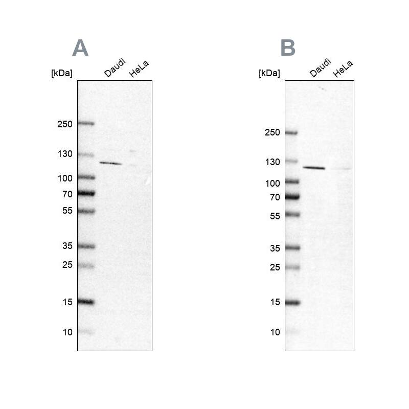LEMD3 Antibody Western Blot: LEMD3 Antibody Antibody [NBP1-81265]