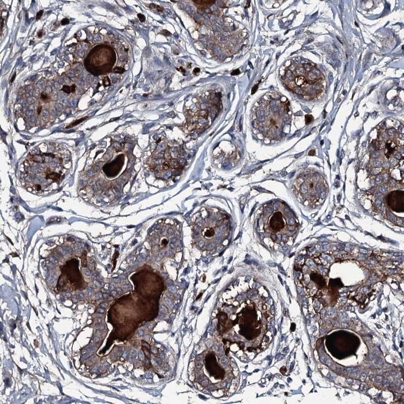 LYG2 Antibody - BSA Free Immunohistochemistry-Paraffin: LYG2 Antibody [NBP1-81278]