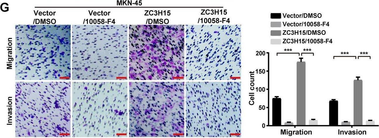 ZC3H15 Antibody - BSA Free