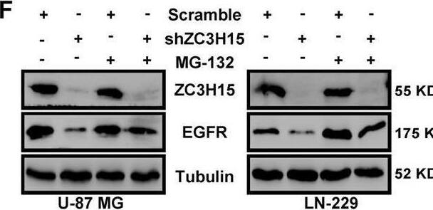 ZC3H15 Antibody - BSA Free