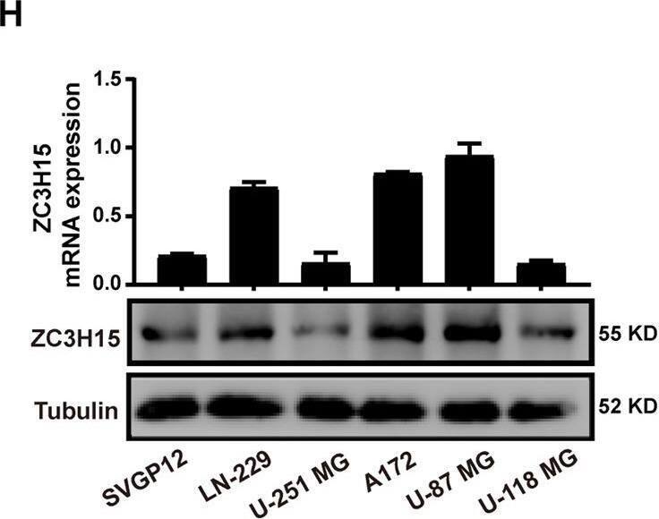 ZC3H15 Antibody - BSA Free