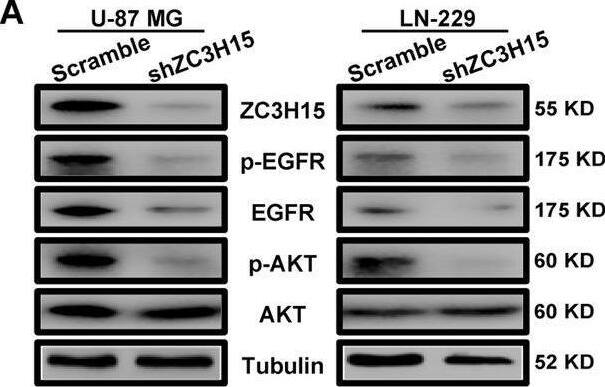 ZC3H15 Antibody - BSA Free