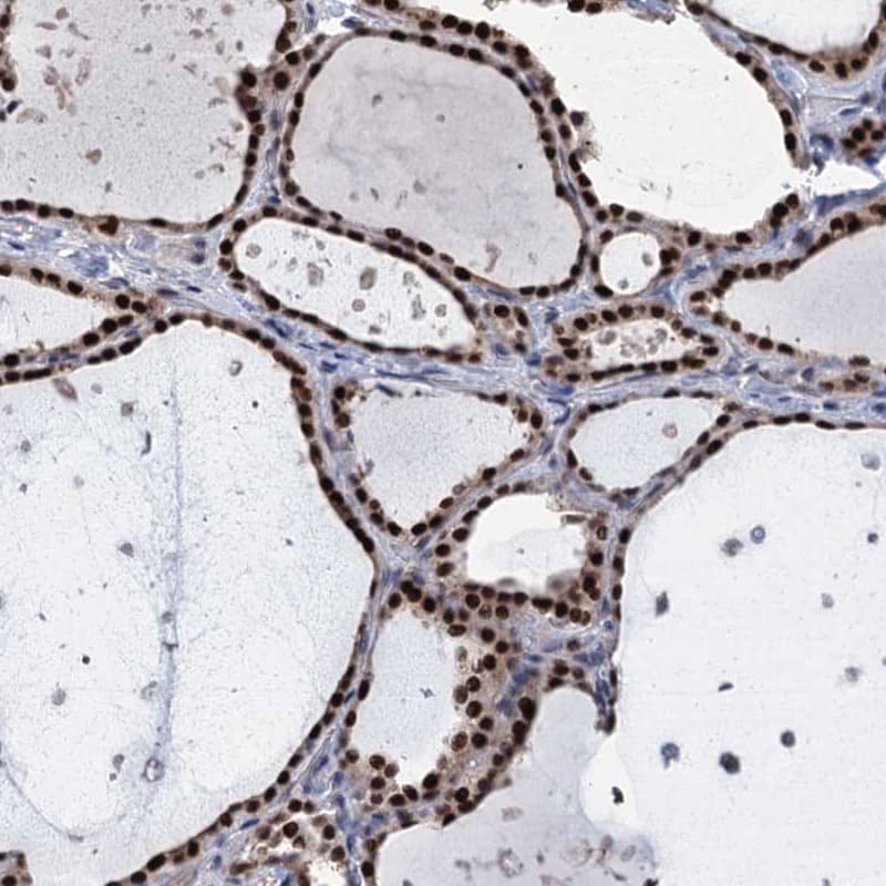 TSEN34 Antibody - BSA Free Immunohistochemistry-Paraffin: TSEN34 Antibody [NBP1-81315]